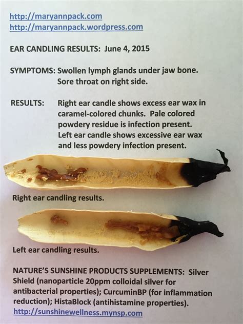 ear candle results